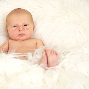 Nappy shot 4 week old baby